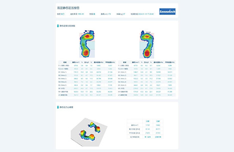 Bi-foot Static Foot Pressure Report