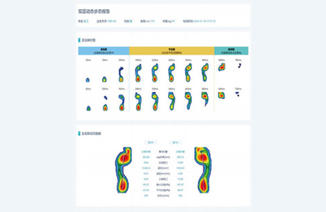 Dynamic Gait Report of Both Feet