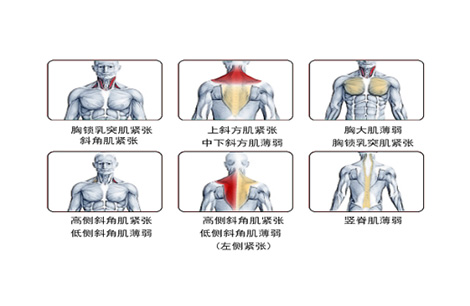 Muscle Status Analysis