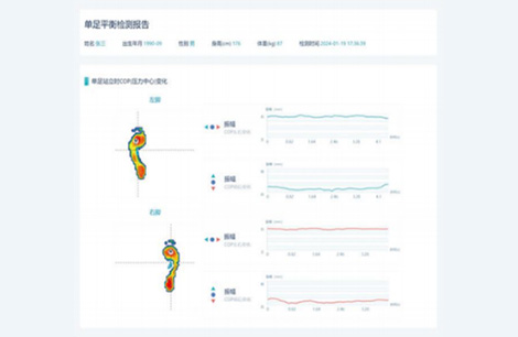 Single Foot Balance Test Report