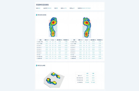 Static Foot Pressure Report of Both Feet
