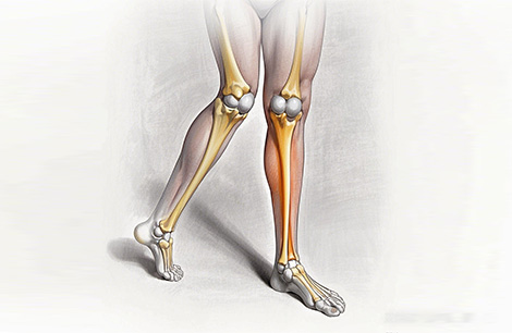 X-shaped Legs